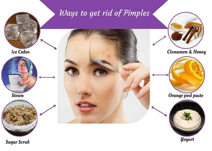 Some Ways to Get Rid of Pimples Fast
